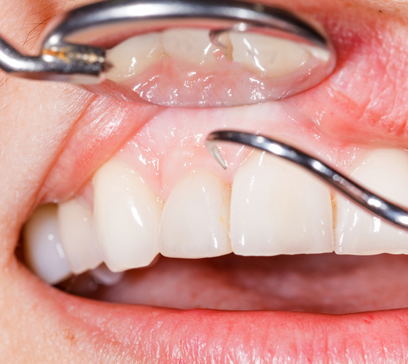 Dentist taking comprehensive oral exam in Richmond Hill