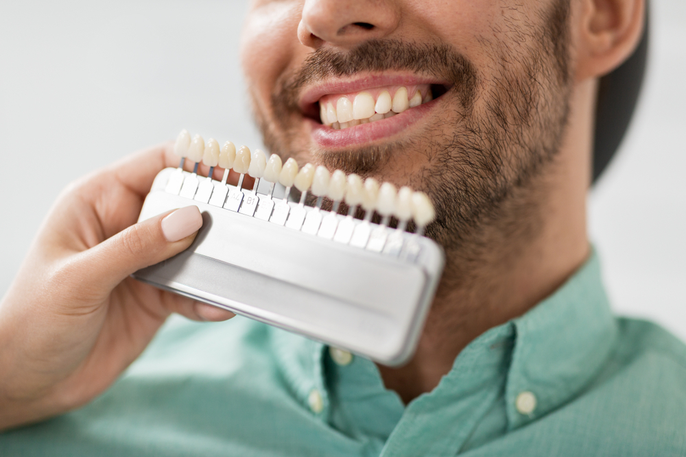 Do Dental Veneers Cover Defective Teeth?