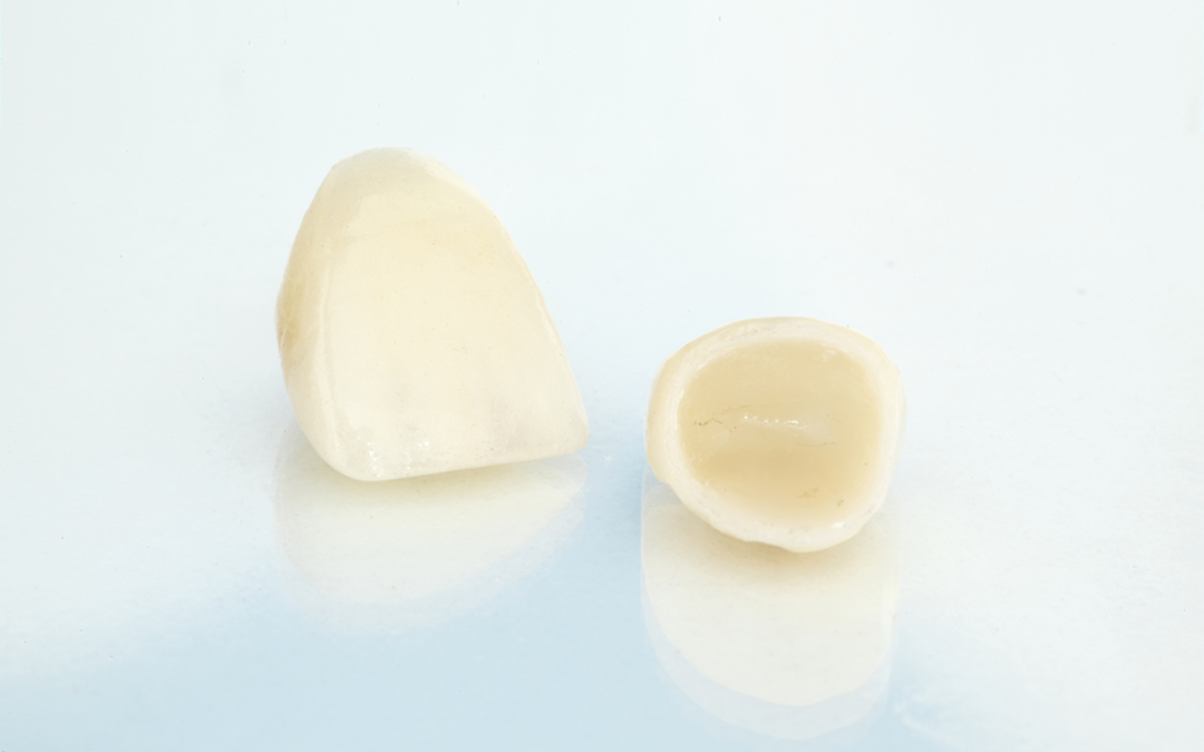 Tips for Dental Crown Procedure